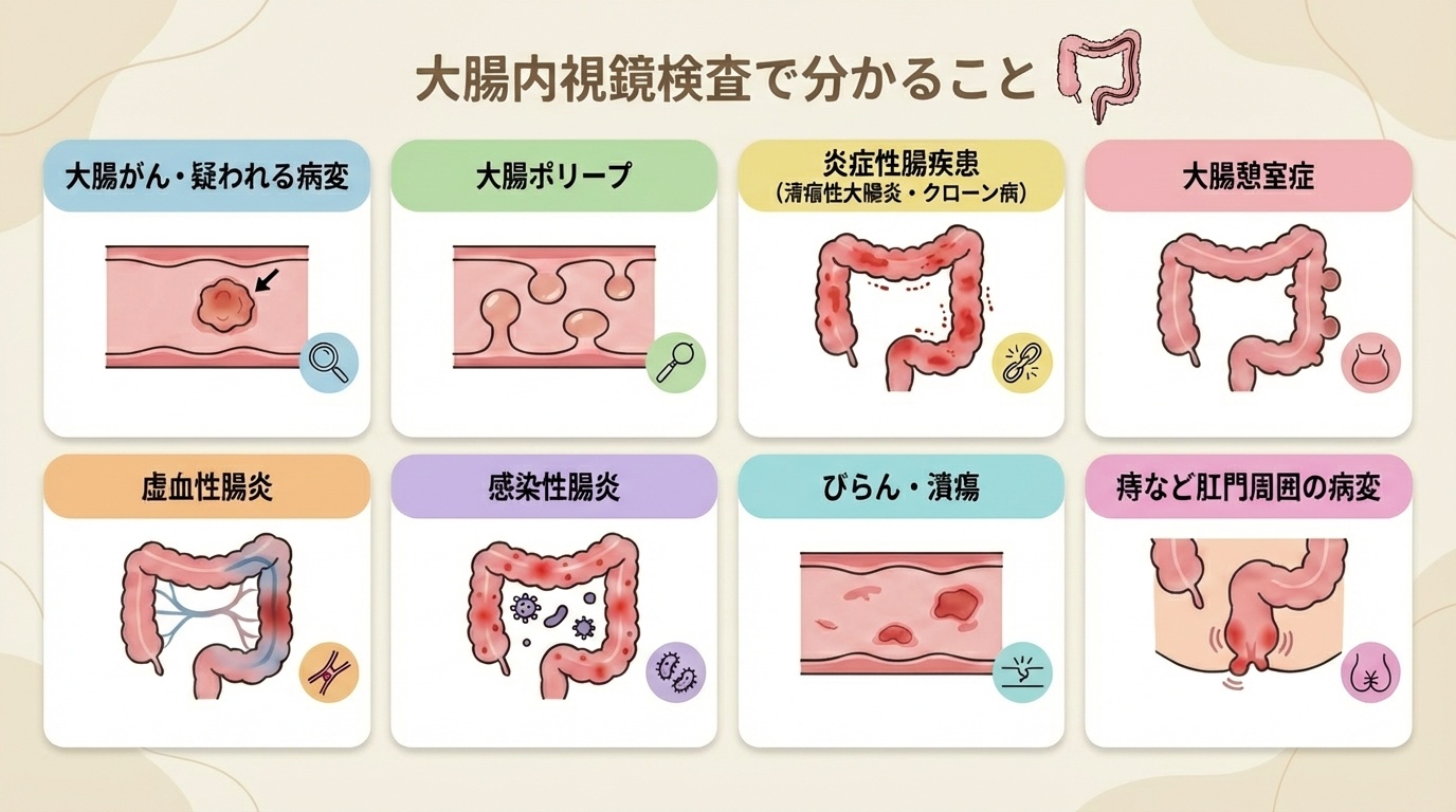 大腸 内 視 鏡 検査 時間