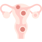 子宮筋腫・卵巣嚢腫